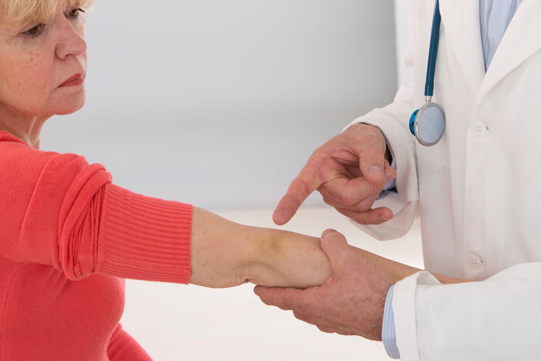 Docteur qui explique à une senior la raison de son hématome